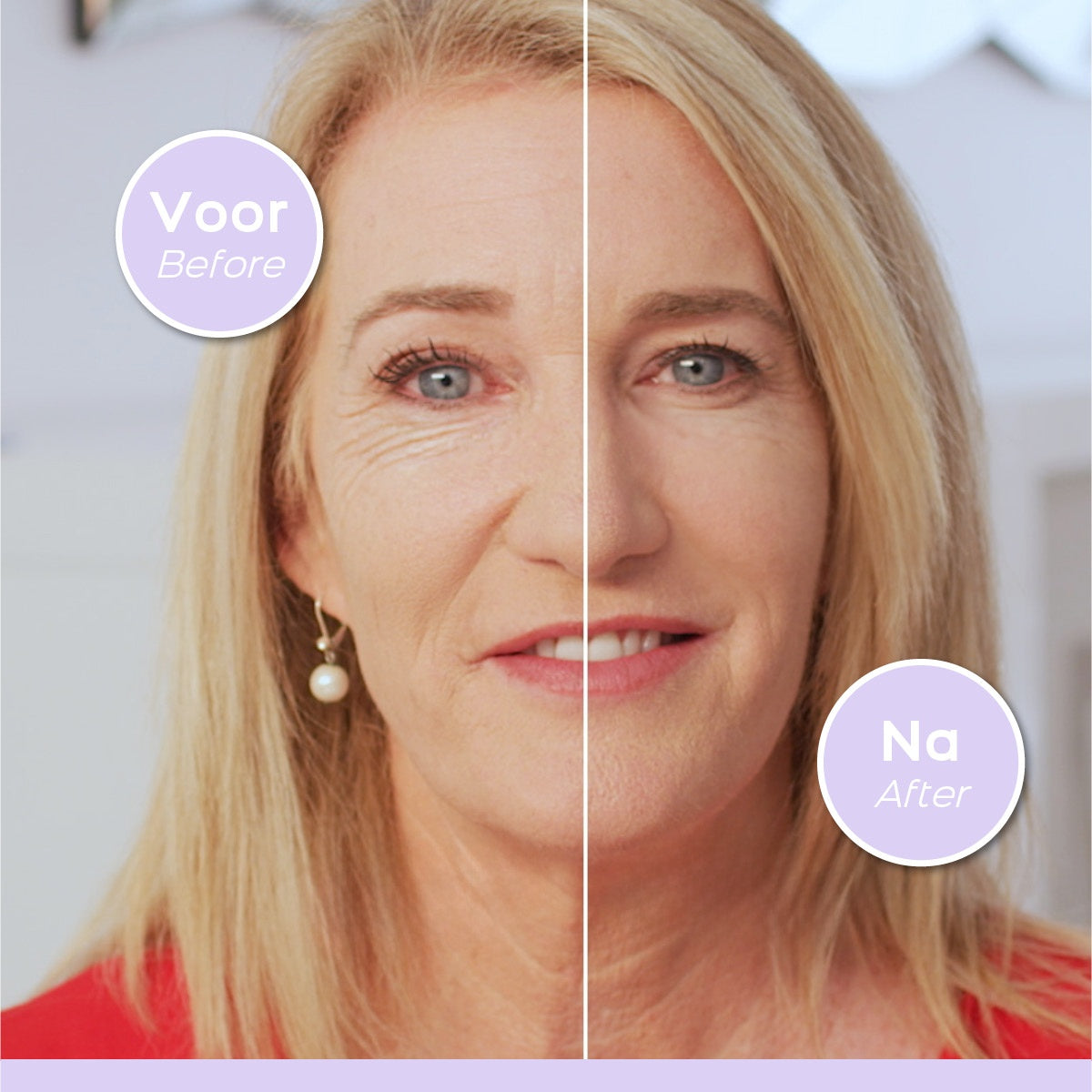 Anti-Wrinkle Serum with Syn-Ake & Pepha-Tight, 30ml
