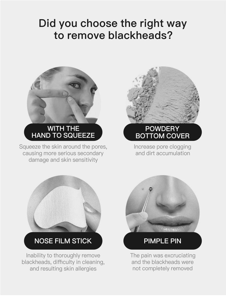 Cenocco Beauty Blackhead Remover Vacuum