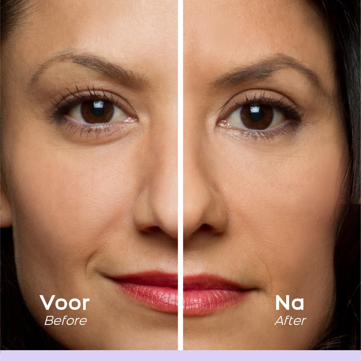 Easy Lift - Eyelid Stickers - Premium