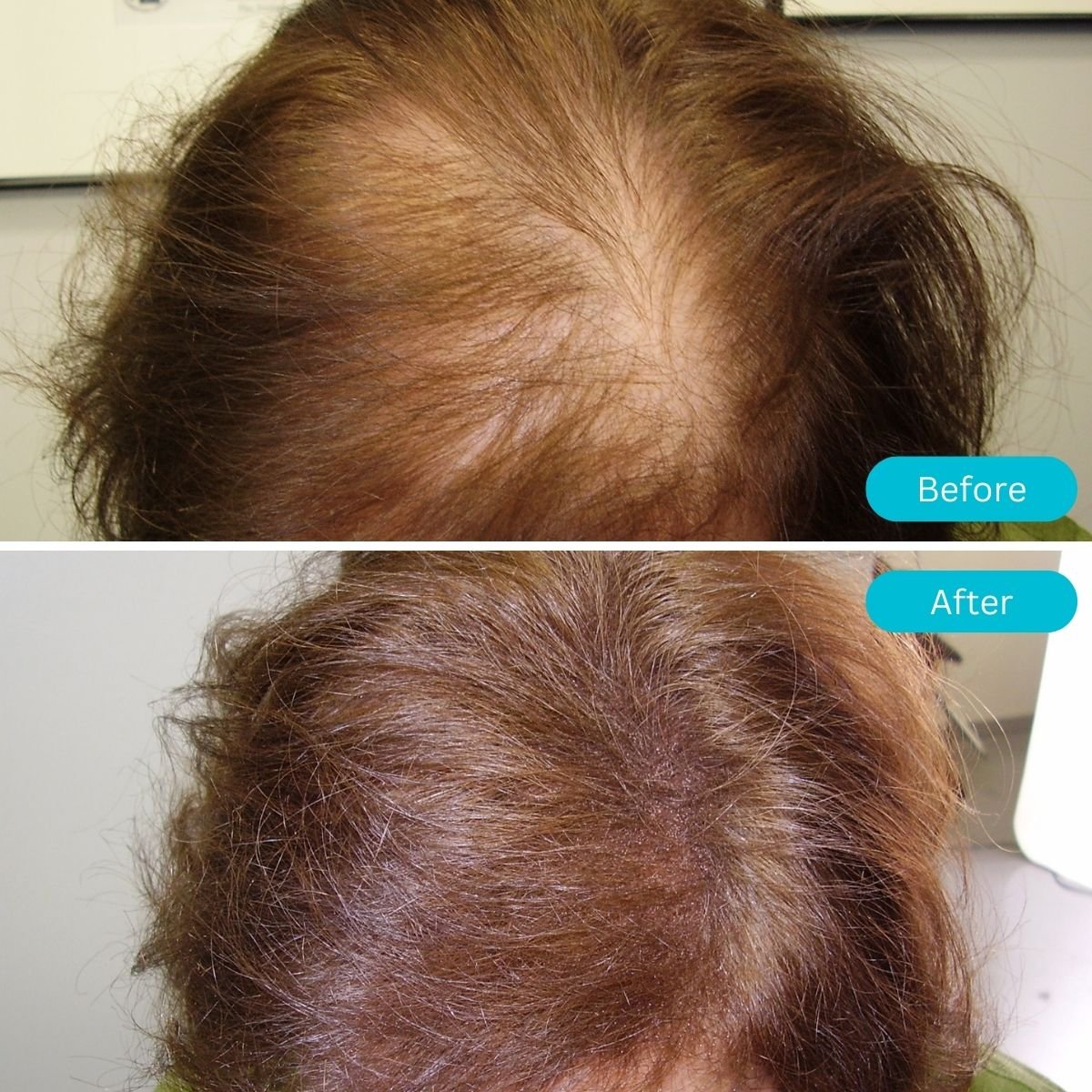 Hair Pro Light Blonde