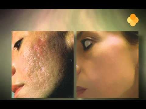 Orange Care - Baba de Caracol cream