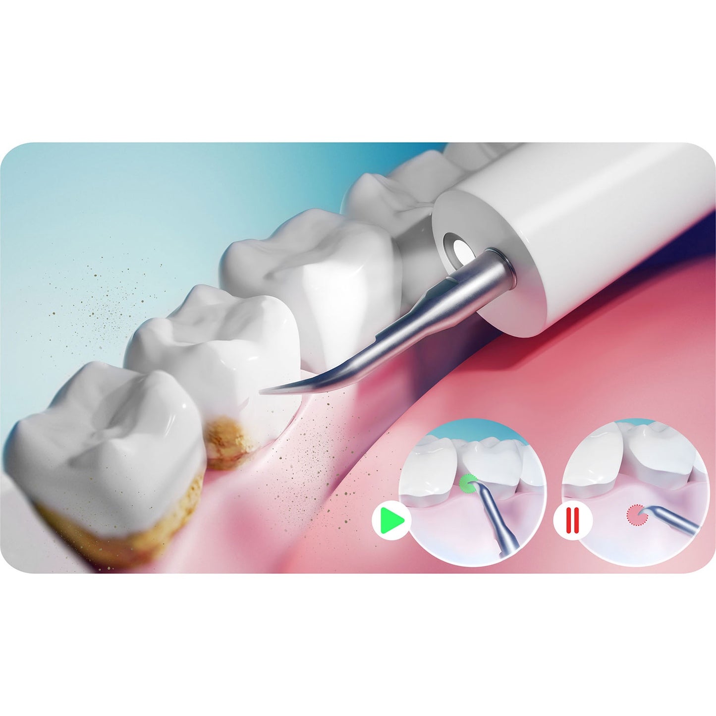 Ultrasonic Dental Scaler, 4 Modes, LED Light, 4 Heads