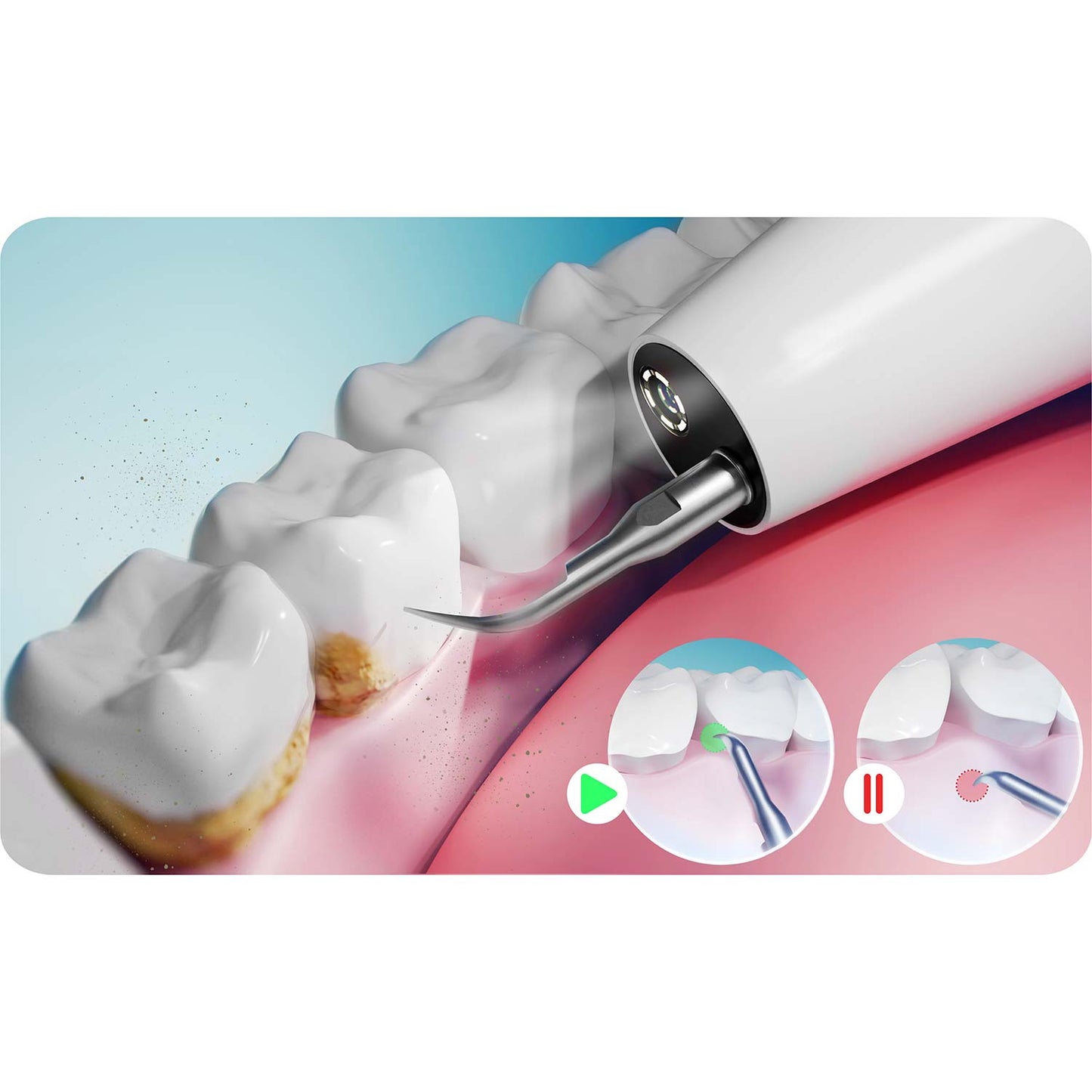 Ultrasonic Dental Scaler with Camera, 4 Modes, LED Light