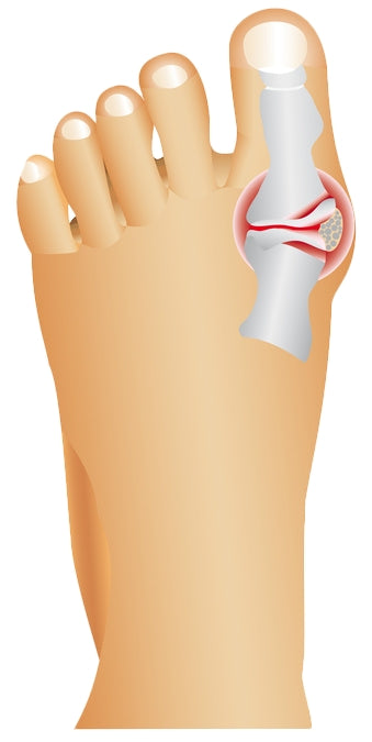 Wellys Night Toe Regulator - Pair